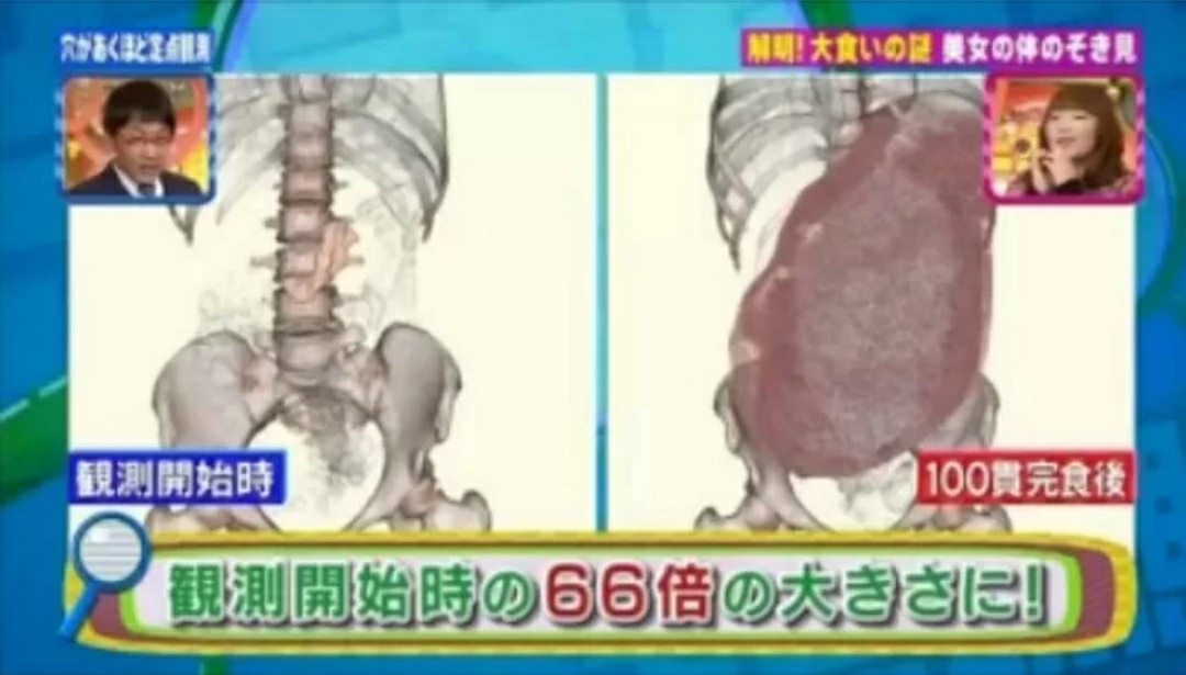 초밥 100개를 먹은 직후 배 속에서 일어나는 현상. 해당 방송 캡처