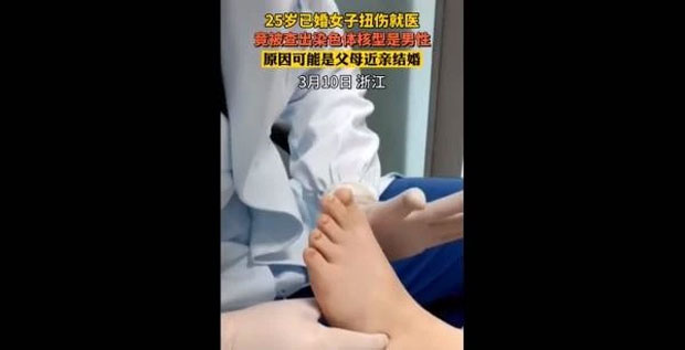 익명의 25살 중국 여성은 얼마 전 발목을 다쳐 병원을 찾았다가 자신의 성별에 얽힌 비밀을 알게 됐다. 엑스레이상 유난히 발달하지 않은 발목을 이상하게 여긴 의료진은 추가 진료에서 이 여성에게 월경이 단 한 번도 없었다는 걸 확인했다. 그도 그럴 것이, 여성에게는 자궁과 난소가 없었다.