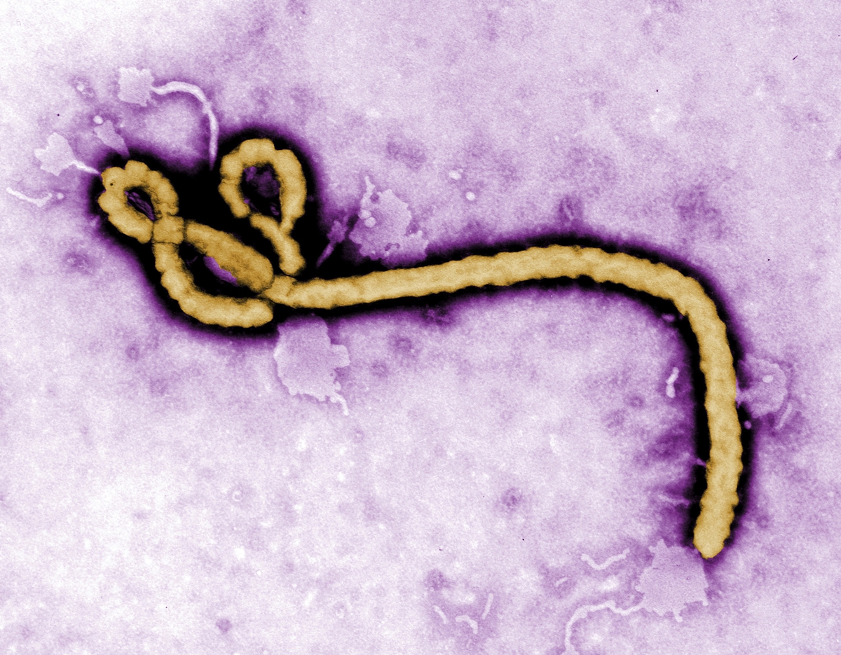 미국 질병통제예방센터(CDC)가 전자현미경으로 촬영해 색 처리를 한 에볼라 바이러스의 모습.  AP 연합뉴스