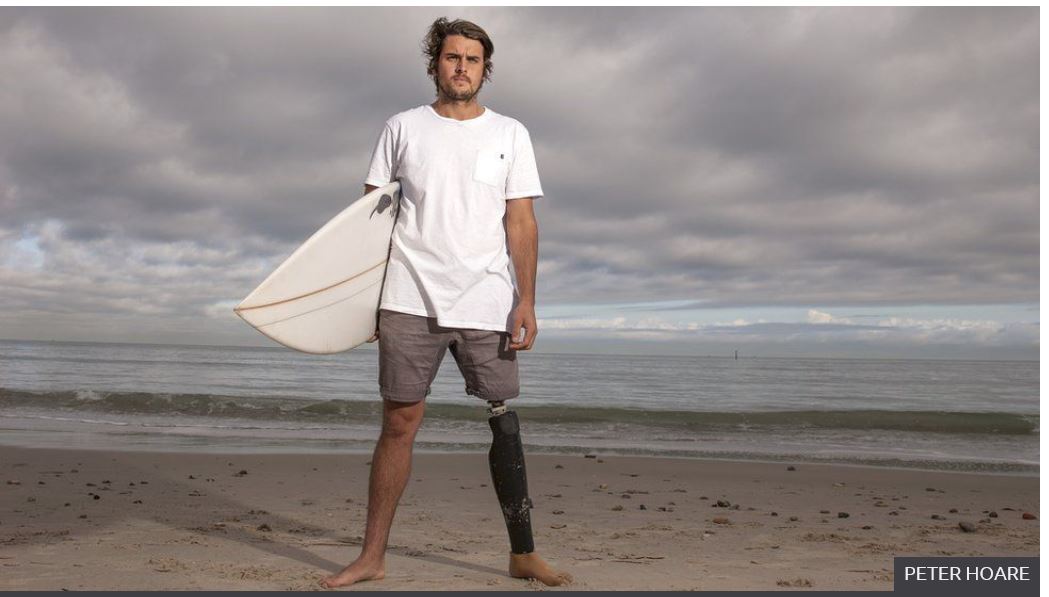 2015년 4월 서핑을 즐기다 백상아리 공격을 받고 왼쪽 다리를 잃은 크리스 블로웨스는 지금은 의족을 단 채 여전히 서핑을 즐긴다. 맨 아래는 그의 서핑보드에 박혀 있던 백상아리의 이. 그는 주법의 예외를 인정받아 기념품으로 소장하고 있다. 피터 호아 제공