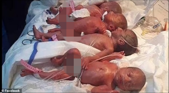 모로코에서 아홉 쌍둥이가 태어났다. 페이스북 캡처