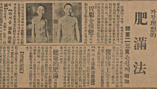매일신보 1930년 11월 3일자에 실림 ‘비만법(살 찌는 법)’ 광고.