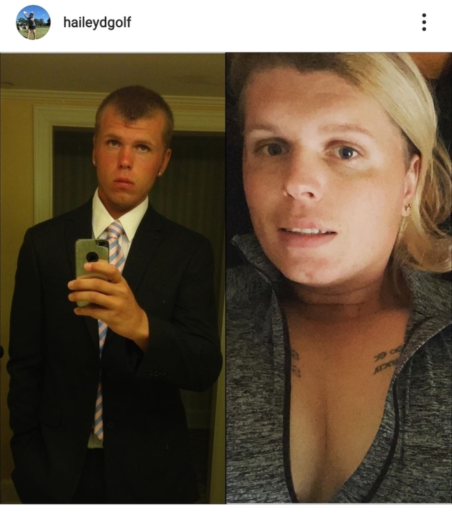 헤일리 데이비드슨의 성전환 수술 이전(왼쪽)과 이후 모습. 데이비드슨 소셜 미디어(SNS) 사진 캡처.