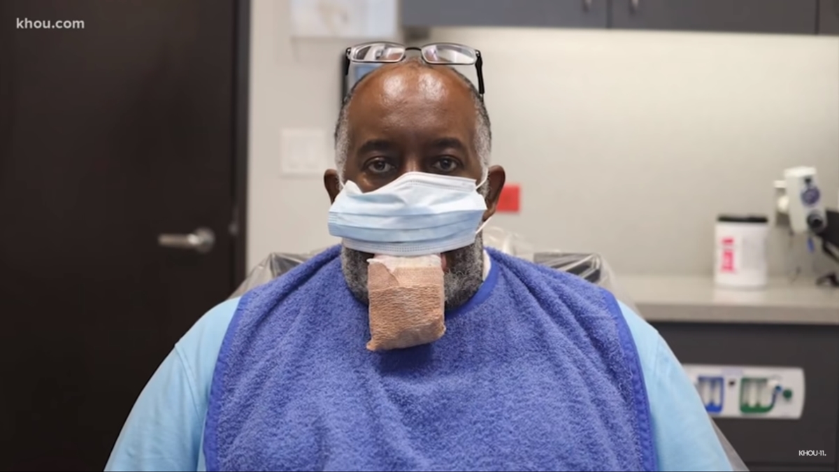 미국 텍사스주에 사는 앤서니 존슨은 지난해 7월 코로나19에 감염된 뒤 혀가 부풀어오르는 ‘대설증’을 겪고 치료를 받았다.  KHOU 11 유튜브 캡처