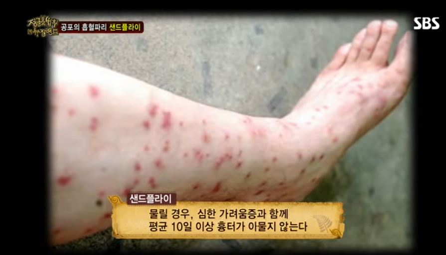 공포의 흡혈곤충 샌드플라이. SBS 정글의 법칙 영상 캡처