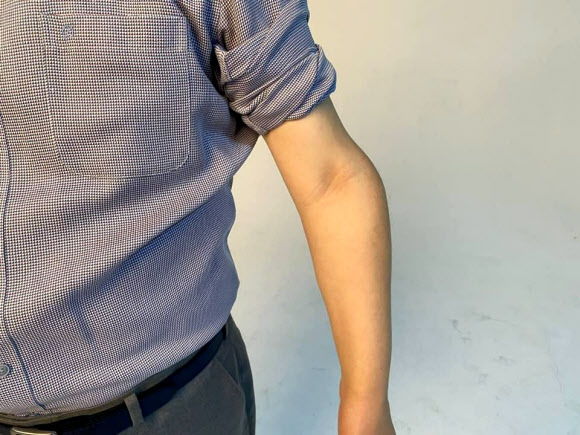 더불어민주당 대권주자인 이재명 후보는 17일 소년공 시절 부상으로 비틀어진 자신의 팔 사진을 공개했다.  연합뉴스