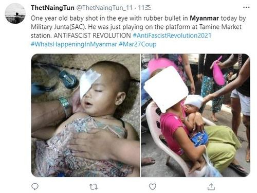 미얀마 군경의 총격에 양곤 교외의 집 근처에서 놀던 한 살 배기 여자 아이가 눈에 고무탄을 맞아 부상을 입은 모습이 사진을 통해 소셜네트워크서비스(SNS)에 퍼졌다. 트위터 캡처