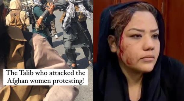  “여성 시위대에 폭력 행사하는 탈레반과 피 흘리는 아프간 여성”