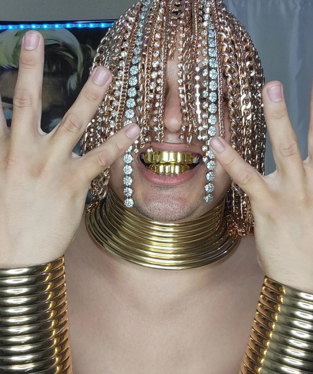 멕시코 래퍼 단 수르가 머리에 무거운 금 사슬을 이식했다는 소식을 전했다. 단 수르 인스타그램 캡처