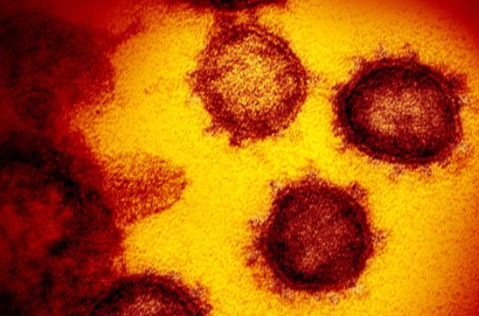 신종 코로나바이러스(2019-nCoV)의 전자현미경 이미지. 27일(현지시간) 미국국립보건원(NIH)이 제공한 것. 워싱턴 AFP 연합뉴스