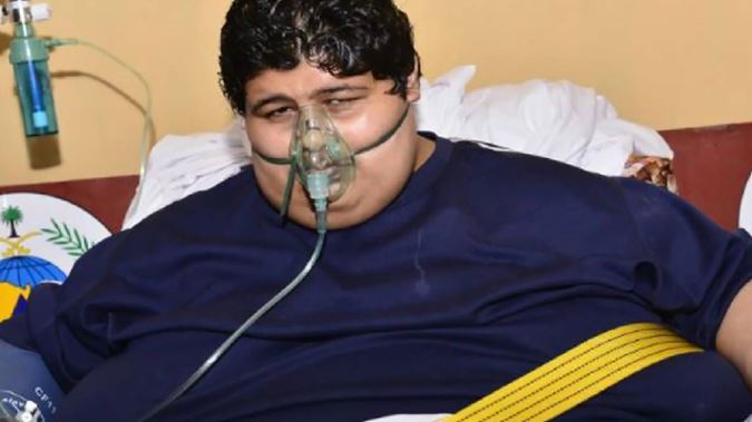 체중 609㎏ 상태로 사우디아라비아 킹 파드 메디컬 시티에 후송되던 17세 때의 칼레드 모센 알 샤에리(29).  사우디아라비아 보건부 제공