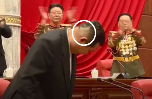 김정은 북한 국무위원장의 오른쪽 뒤통수에 의료용 테이프를 붙였다 뗀 자국이 보인다. 조선중앙TV 방송화면 캡처