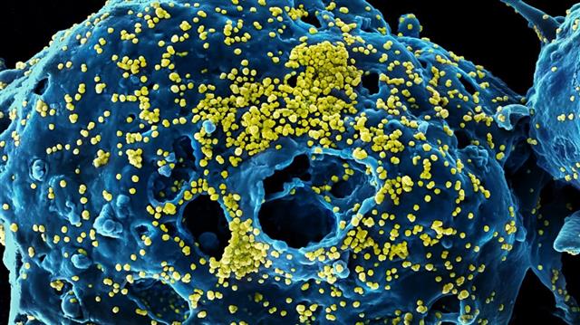 코로나19 바이러스(노란색)가 동물세포에 붙어 있는 모습을 전자현미경으로 찍은 사진. 미국 국립알레르기·감염병연구소(NIAID) 제공