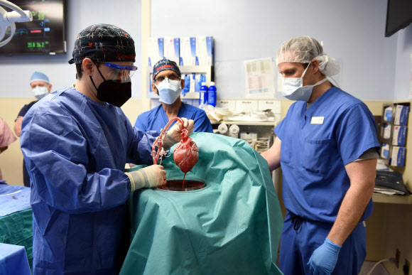무함마드 M 모히우딘(가운데) 박사가 이끄는 수술진이 데이비드 베넷에게 이식하기 위해 유전자를 조작한 돼지 심장을 보여주고 있다. 볼티모어 EPA 연합뉴스 