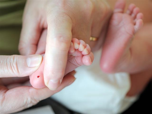 조기 진단이 중요한 유전 질환 검사를 위해 갓 태어난 아이의 발바닥에서 채혈을 한다. 미국 시카고대 제공