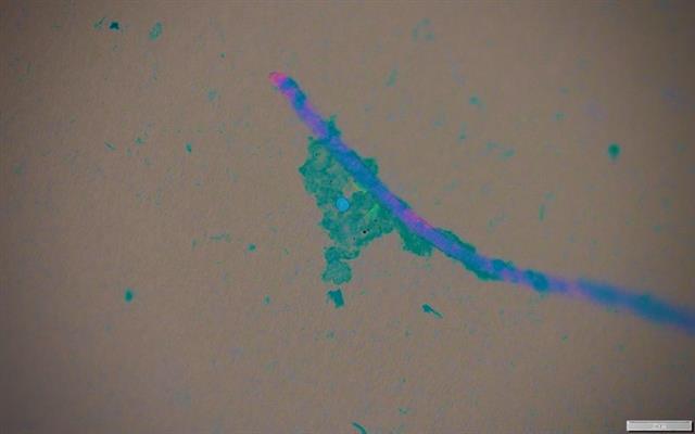 바다로 흘러 들어간 미세섬유 조각에 파란색 생체막이 감싸고 있다. 여기에 고양이 배설물에 포함된 독소균인 ‘톡소포자충’(파란색 점), 편모충증을 일으키는 ‘지알디아’(녹색 점)가 붙어 있다. UC데이비스 제공