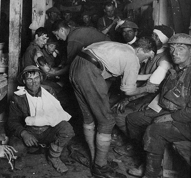 1차 세계대전 당시인 1917년 벨기에의 응급치료소에서 한 영국 부상병(왼쪽 아래)이 폭발로 인한 신경 불안 증세인 ‘탄환 충격’ 증상으로 멍한 표정을 짓고 있다.  메멘토 제공