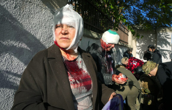 10일(현지시간) 러시아의 민간인 공격으로 인해 우크라이나 수도 키이우에서 부상당한 우크라이나 시민들. AP