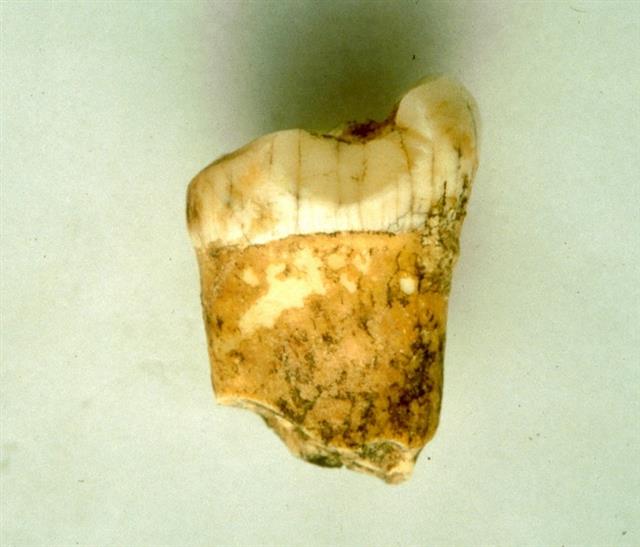 먹이사슬 내에서 네안데르탈인의 위치를 찾기 위해 분석에 사용된 어금니 화석.  프랑스 리옹지질학연구소 제공