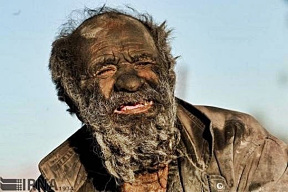 23일(현지시간) 이란 파르스주 농촌마을 데즈가에서 ‘세상에서 가장 더러운 남자’로 불리던 ‘아모 하지’(하지 아저씨)가 94세를 일기로 사망했다. 이란 국영통신사 IRNA 자료사진