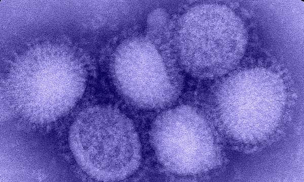 1919년 스페인 독감과 2009년 독감 대유행을 일으켰던 H1N1 인플루엔자 바이러스의 모습. CDC 제공