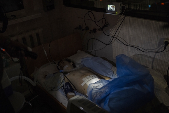 22일(현지시간) 우크라이나 남부 헤르손의 한 병원에서 러시아군 공격으로 다친 소년이 정전 속에 누워 있다. 2022.11.23  AP 연합뉴스