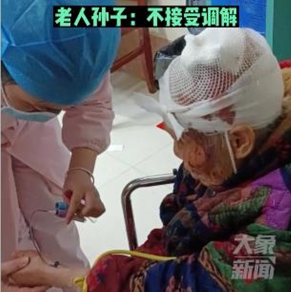 춘제 연휴 며느리에게 구타당한 중국 80대 노인.  웨이보