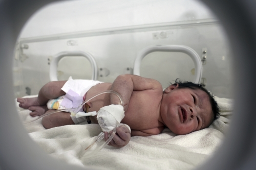7일 시리아 지진 피해 현장에서 탯줄을 달고 있는 상태로 구조된 아기가 알레포 지역 아프린의 병원 인큐베이터에서 치료를 받고 있다.  아프린 AP 연합뉴스