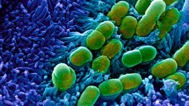 전자현미경을 이용해 찍은 대장 속 대장균(녹색). 이미지네이처 제공