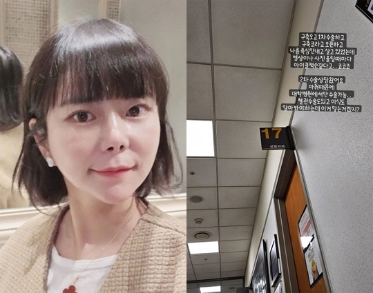 개그맨 이수근 아내 박지연이 코 성형수술을 고민 중이라고 밝혔다.  SNS 캡처