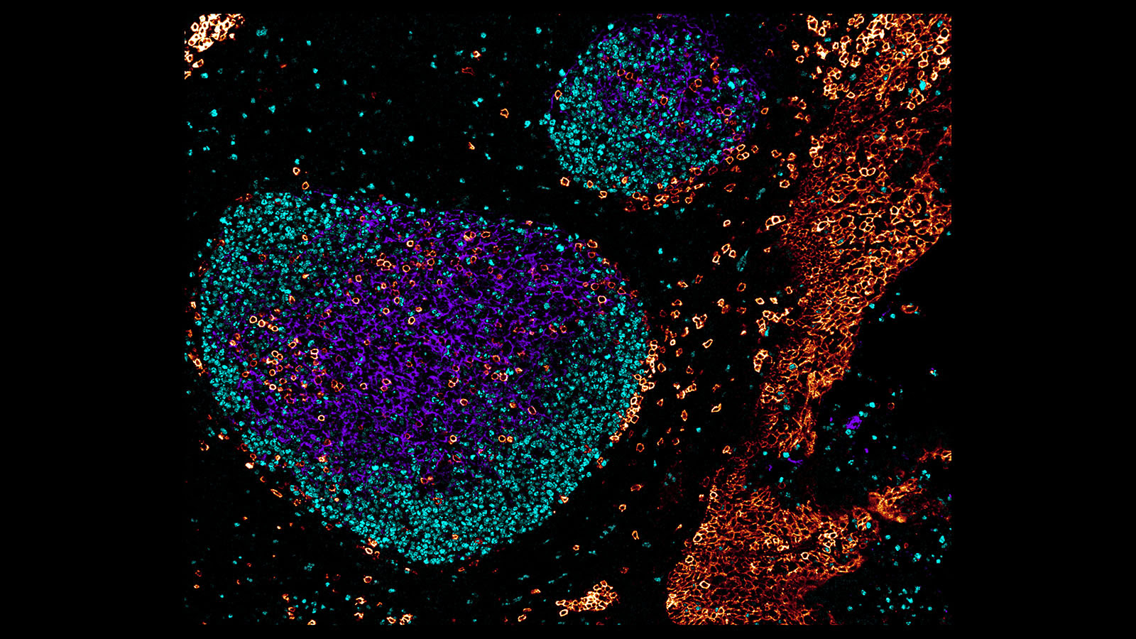편도선은 인간 면역시스템의 첫 번째 방어선이다. 독일 연구진이 공초점 현미경으로 촬영한 편도선의 조직과 세포. 사진에서 볼 수 있듯 편도선은 세 종류의 다른 세포들로 구성돼 있다. 흔히 조직은 한 종류의 세포로 구성돼 있을 것으로 생각하지만 다양한 세포로 구성돼 있다. HuBMAP 제공