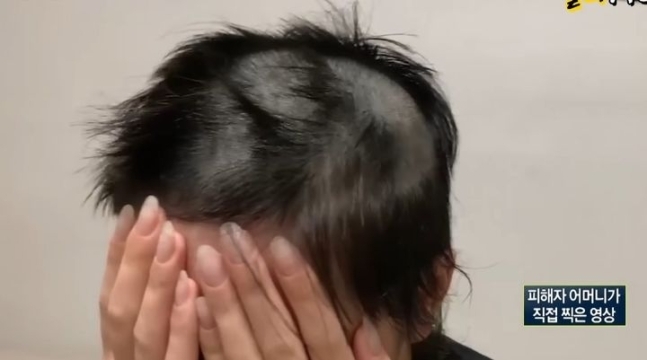 남자친구에게 폭력을 당하고 바리캉으로 머리를 밀리는 등 데이트 폭력을 당한 여성이 자신이 당한 피해 사실을 구체적으로 밝혔다. MBC 실화탐사대 유튜브 캡처