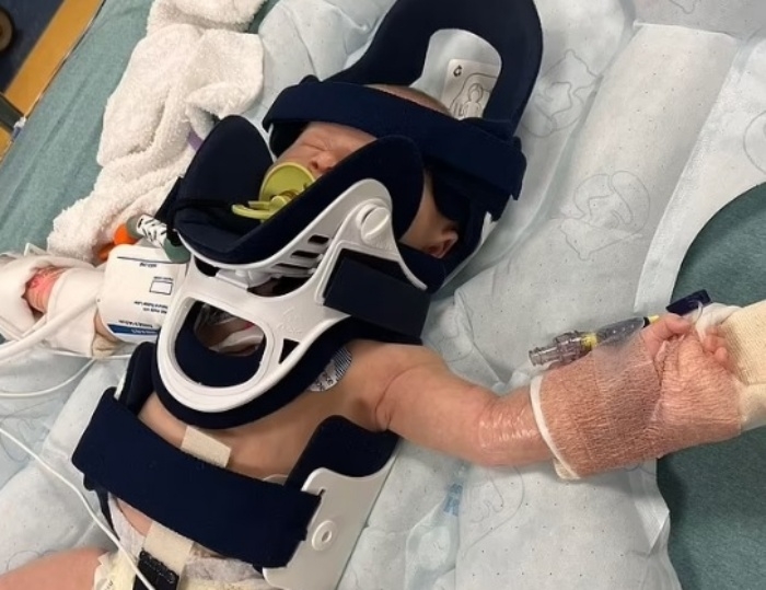 생후 3주였던 조지아 프레스트우드가 미국 노스캐롤라이나주 히코리시의 야구장에서 파울볼에 맞아 두개골 골절과 뇌출혈로 치료를 받는 모습. WBTV 캡처
