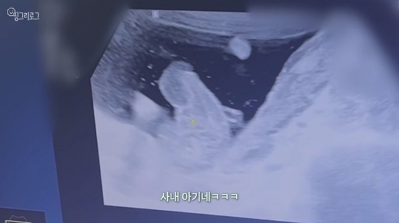 오상진, 김소영 부부의 둘째 성별이 공개됐다. 유튜브 ‘김소영의 띵그리TV’