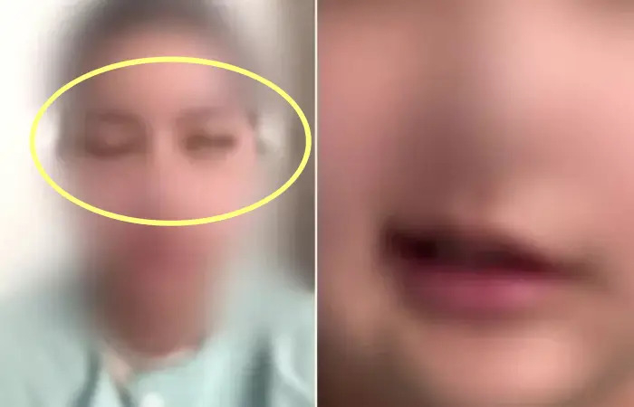 서울 강남의 한 유명 성형외과에서 수술을 받은 뒤 안면이 마비된 20대 여성 환자. JTBC 보도 캡처