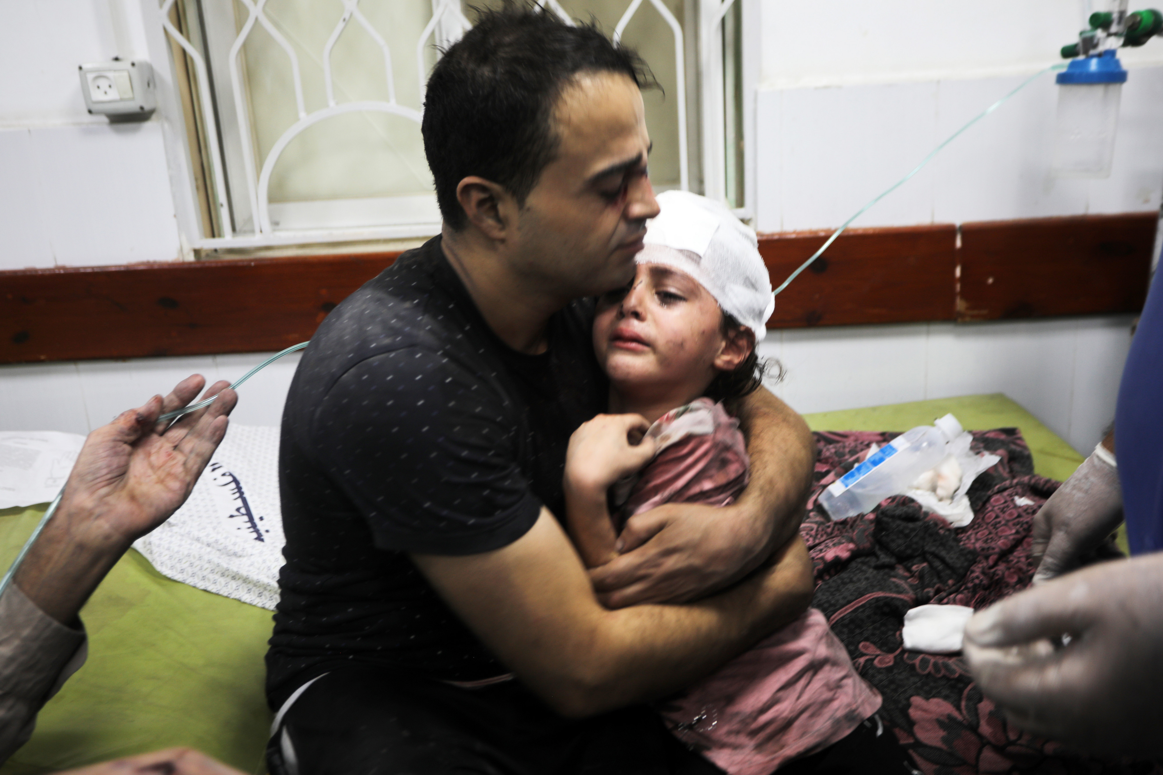 팔레스타인 가자지구 남부 라파 난민촌의 병원에서 이날 한 남성이 이스라엘군의 공습으로 다친 딸을 안고 있는 모습. 가자 UPI 연합뉴스