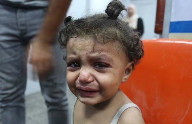 이스라엘의 가자지구 공습으로 부상을 입은 팔레스타인 소녀가 30일 라파의 한 병원에서 울고있다. AP 연합뉴스