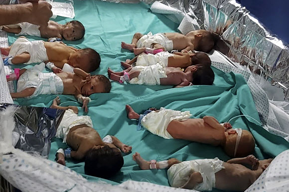지난 12일(현지시간) 팔레스타인 가자지구 최대 의료시설인 알시파 병원에서 태어난 미숙아들이 연료 부족으로 가동이 중단된 인큐베이터에서 꺼내져 침상 위에 그대로 놓여 있다. 마라완 아부 사다 박사 제공 AP 연합뉴스