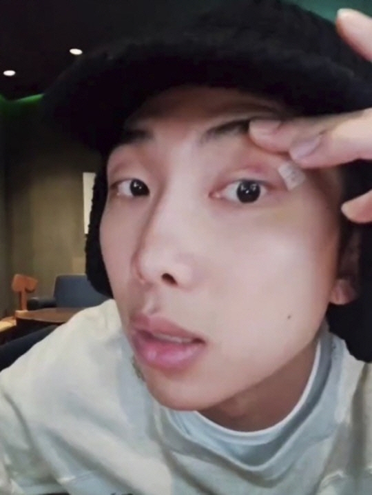 방탄소년단(BTS) RM이 촬영 중 눈가 부상을 당했다. 위버스