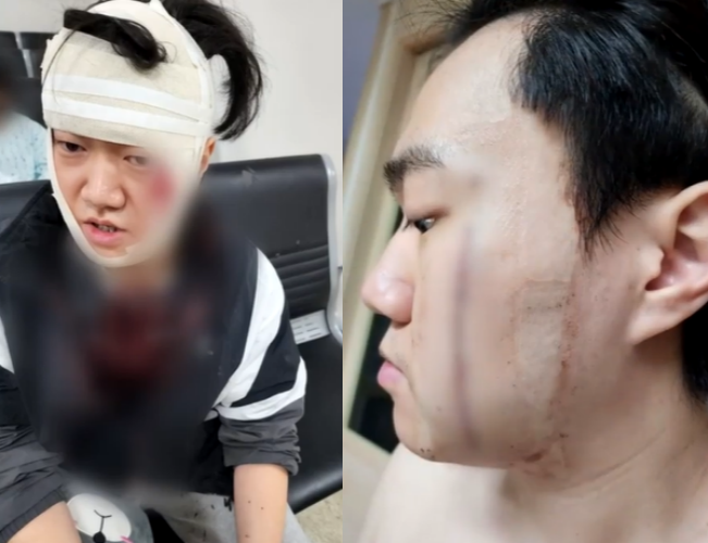 ‘묻지마 폭행’을 당하고 있던 피해 여성을 구한 아버지와 아들의 사연이 전해졌다. 사진은 피해 여성을 구한 20대 남성 이수연씨의 모습. JTBC 보도영상 캡처