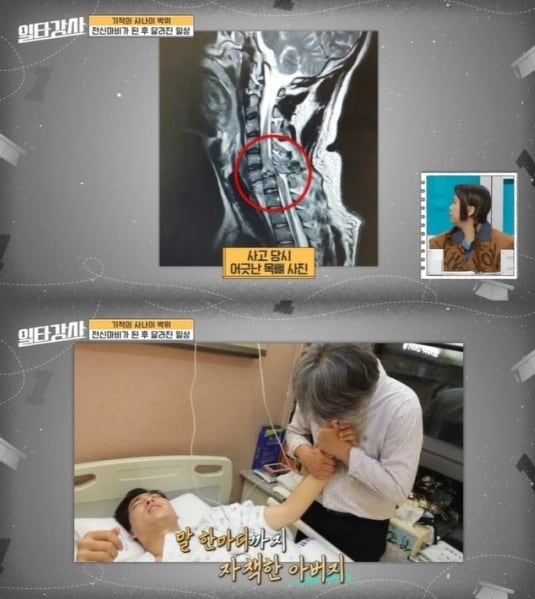 사고 당시 엑스레이 사진(위), 박위를 간호하는 아버지 박찬홍 감독. MBC 캡처