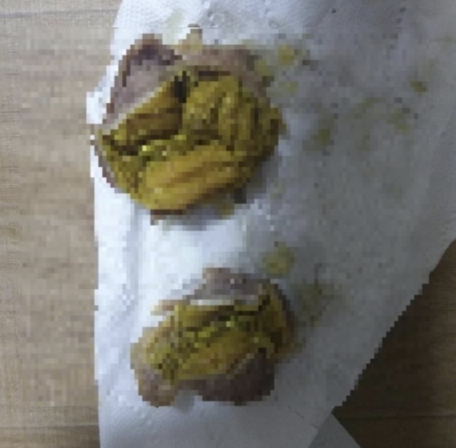 노란 이물질이 든 60계치킨의 닭근위 튀김. 온라인 커뮤니티 캡처