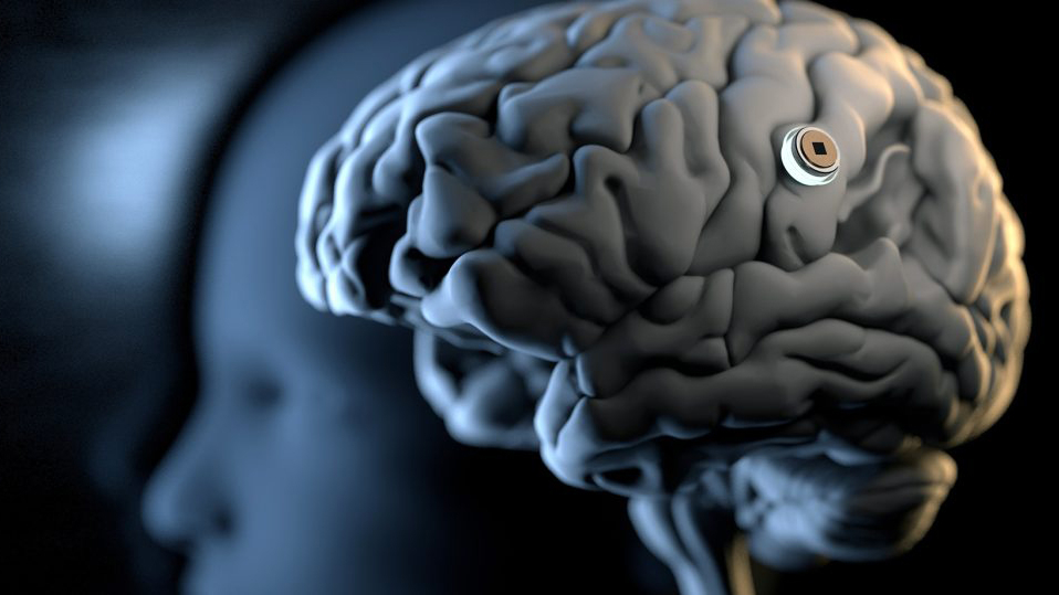 많은 과학자가 뇌에 칩을 이식해 뇌신경질환 치료와 모니터링을 하기 위한 연구를 하고 있다.  뉴럴링크 제공