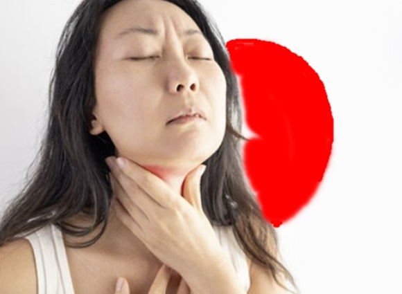 일본 국립감염병연구소는 지난해 일본의 독성쇼크증후군(STSS) 환자가 941명으로 역대 최대를 기록했다고 22일 밝혔다. 인후염 증상 자료사진. 123RF