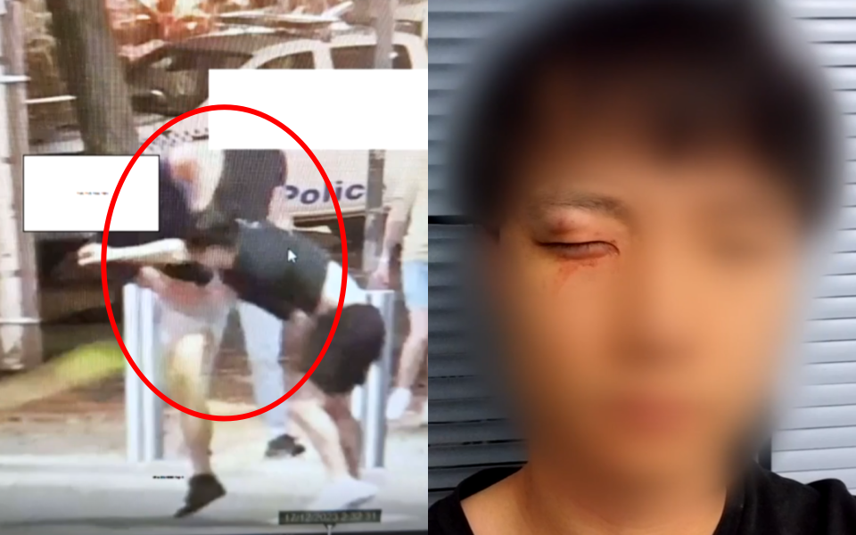 호주 시드니에서 거주하던 20대 한국인 남성이 백인 남성 3명에게 집단 폭행당하는 일이 벌어졌다. 사진은 한국인 남성이 폭행당하는 모습(왼쪽)과 폭행으로 인해 찢어진 눈가. JTBC 보도화면 캡처