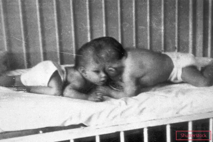 결합쌍생아(샴쌍둥이)로 태어난 로리·조지 샤펠 남매.  기네스세계기록 홈페이지 캡처
