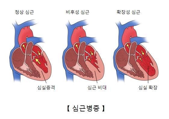 서울아산병원 제공
