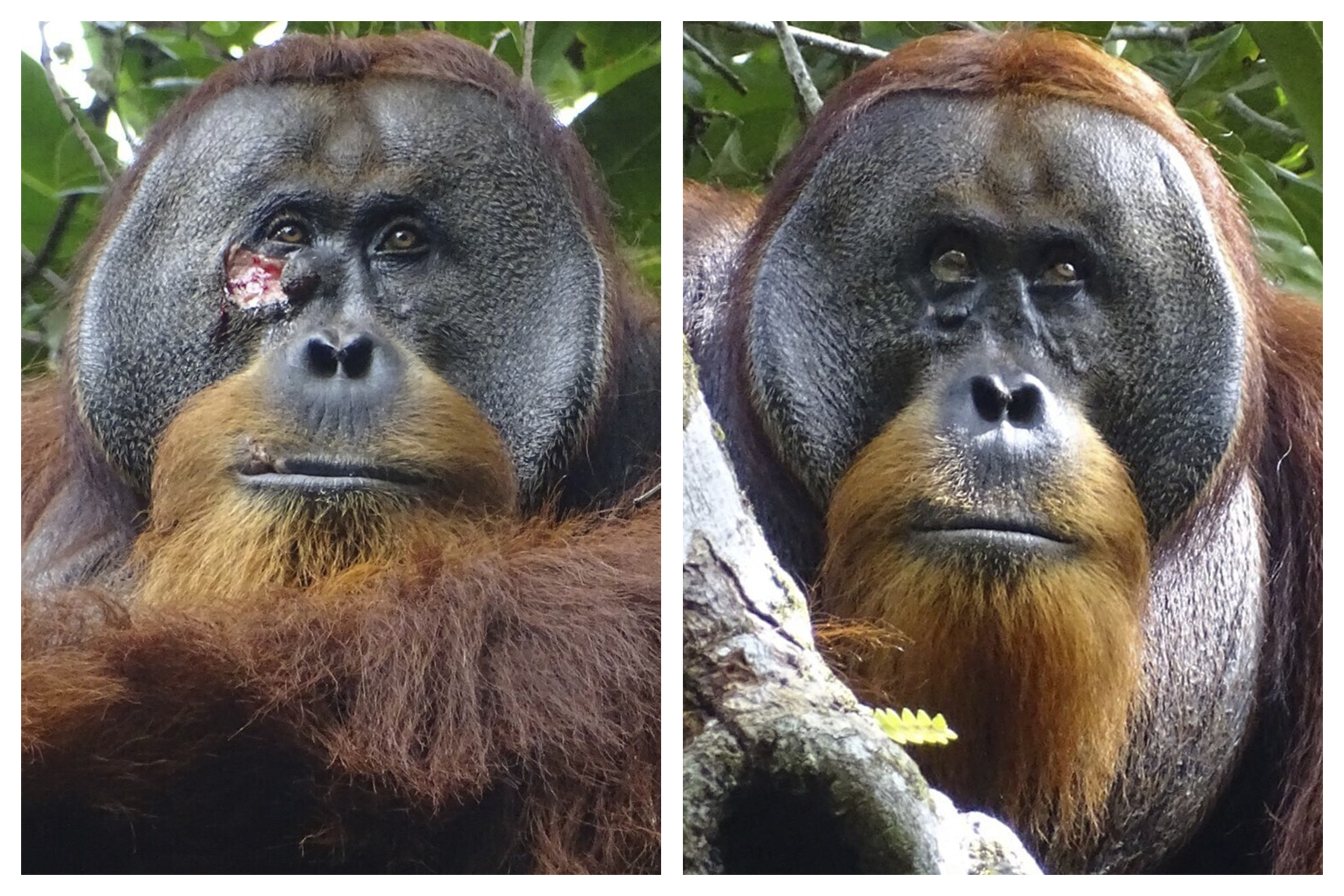 인도네시아 수마트라섬에 사는 수컷 오랑우탄 ‘라쿠스’의 얼굴 오른쪽 눈 아래에 큰 상처가 나 있다(왼쪽). 라쿠스는 약초를 이용해 상처를 치료했는데, 두 달 후쯤 해당 상처가 거의 보이지 않을 정도로 완전히 치유됐다. AP 연합뉴스