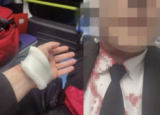 피시방에서 칼에 찔려 목과 손목을 다쳤다며 피해자가 올린 사진. 온라인 커뮤니티 캡처