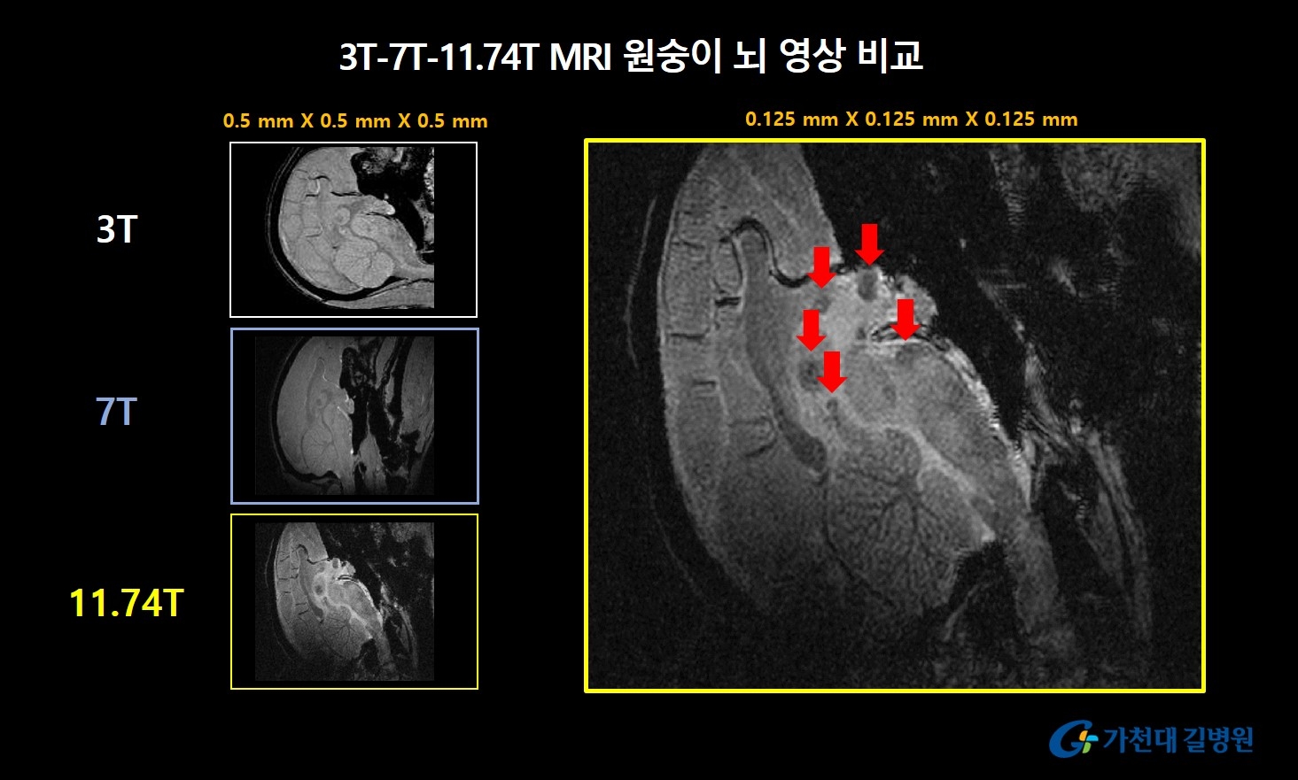 원숭이 뇌 영상 비교